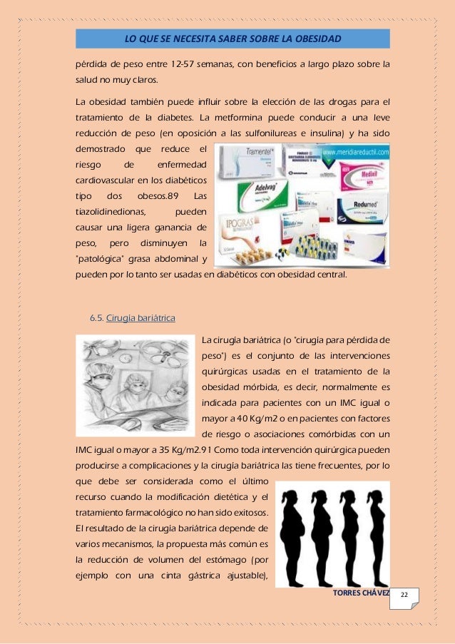 Obesidad Obesidad