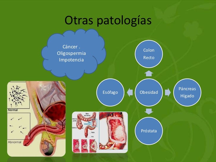 Do que tratar a impotência na diabete