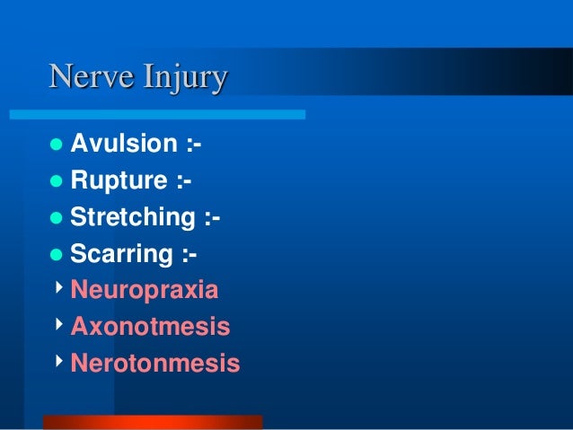 injury underlying obstetrical brachial plexus palsy obpp Obstetrical brachial plexus palsy (obpp) is a complication of difficult unilateral injury is more common than bilateral injury may be the underlying reason for a very low incidence of radioulnar sublocation in our study. injury underlying obstetrical brachial plexus palsy obpp Obstetrical brachial plexus palsy (obpp) is a complication of difficult unilateral injury is more common than bilateral injury may be the underlying reason for a very low incidence of radioulnar sublocation in our study.