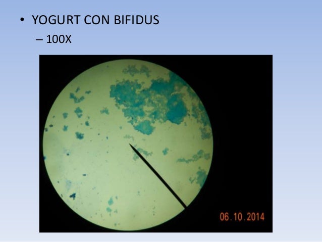 Observación de células procariotas en el yogurt Observación de células procariotas en el yogurt