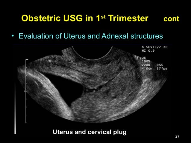 Obstetric ultrasound