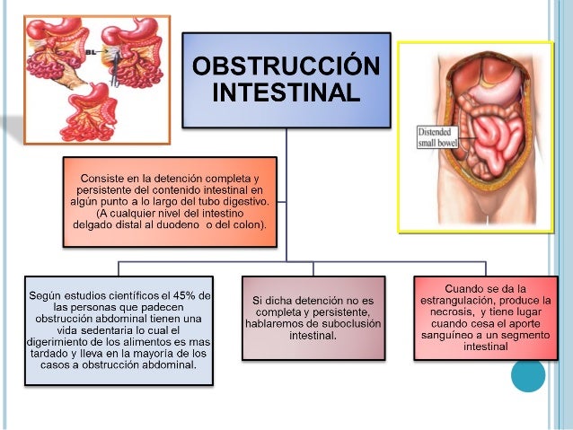 Obstruccion intestinal