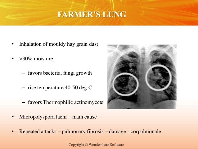 What is the share of asbestos in textured coatings mesothelioma attorneys san francisco