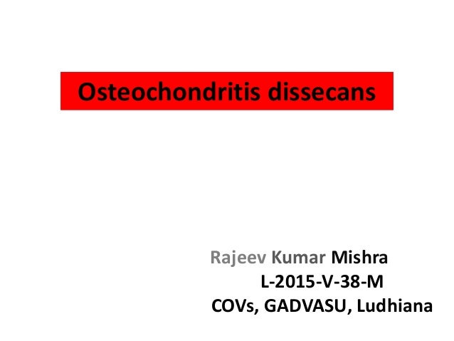 review of osteochondritis dessicans in horses Ocd pellets is effective in the treatment of equine: ocd, osteochondrosis, (osteochondritis dissecans), bone cysts, djd (degenerative joint disease), epiphysitis. review of osteochondritis dessicans in horses Ocd pellets is effective in the treatment of equine: ocd, osteochondrosis, (osteochondritis dissecans), bone cysts, djd (degenerative joint disease), epiphysitis.