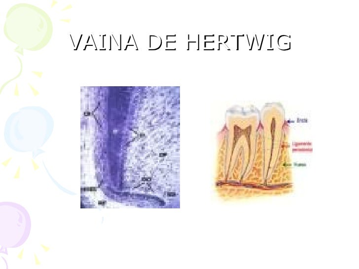 Odontogén..