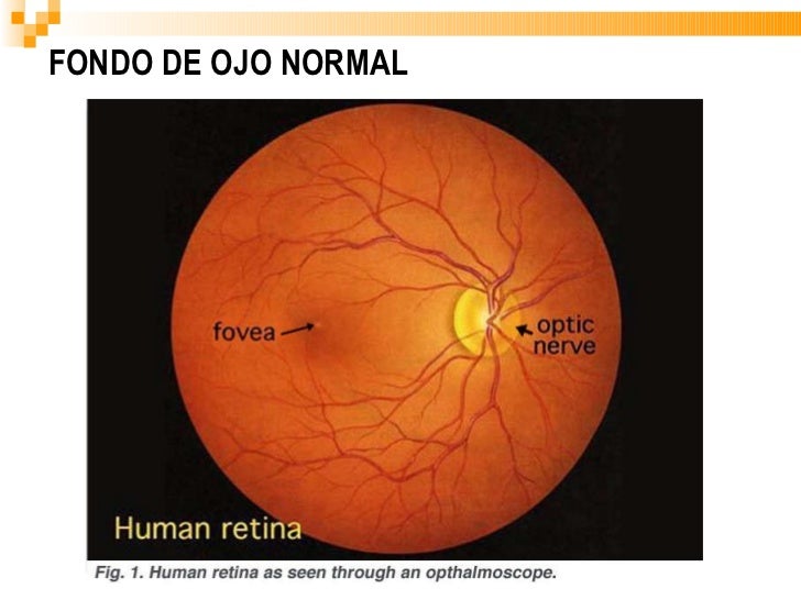 ANATOMIA DEL GLOBO OCULAR