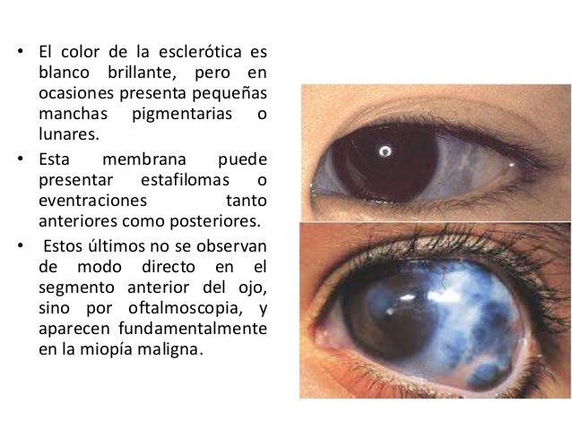 La desaparición de pigmento la mancha en la persona en el salón de belleza