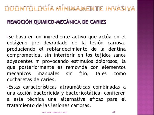que es sin compromiso radicular