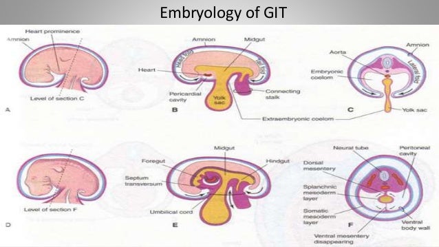 Omphalocele vs gastroschisis