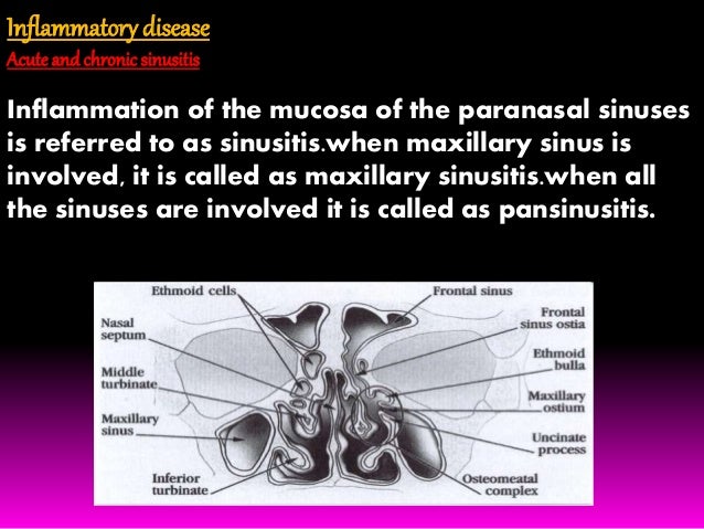 swollen sinus no drainage