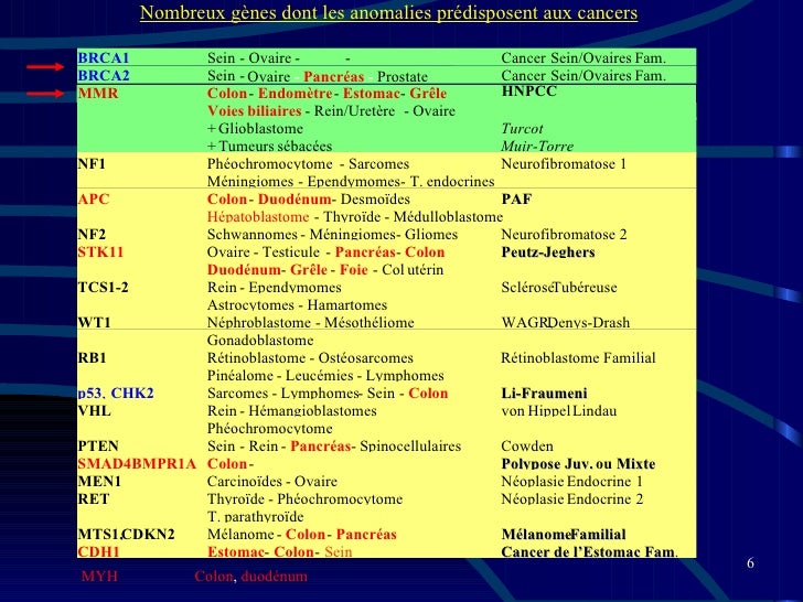 Carcinome Médullaire De los angeles Thyroïde