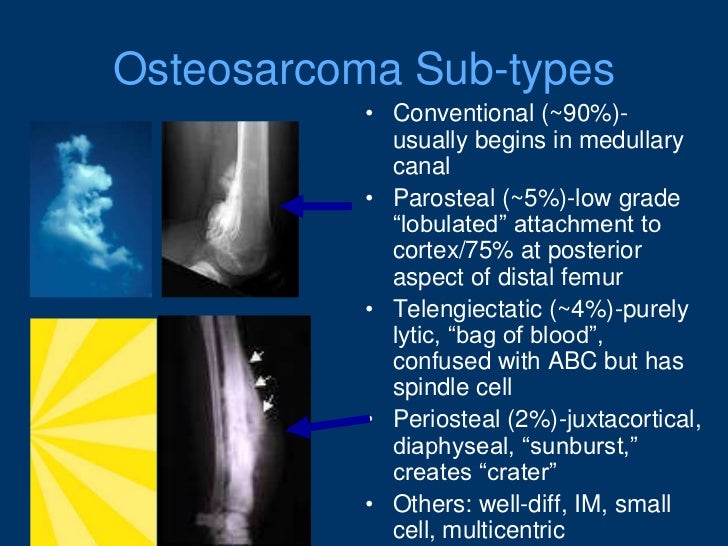 Oncology oitereview2012