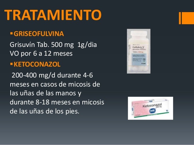 El tratamiento del hongo de los pies y las uñas a los niños