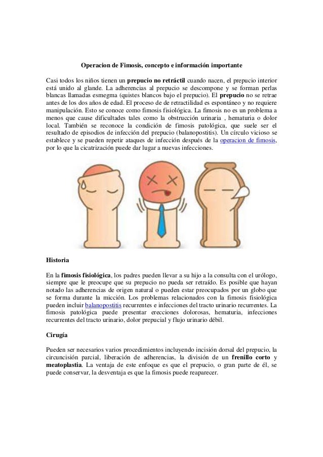 La foto-competición en un más pequeño miembro