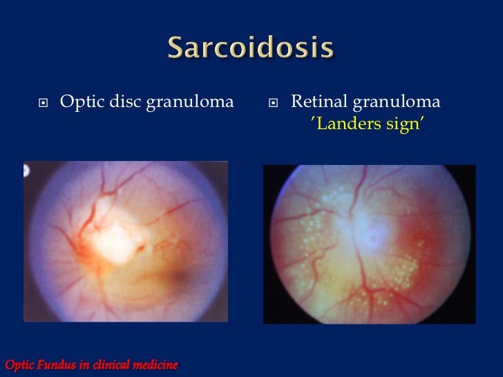 Optic fundus in clinical medicine