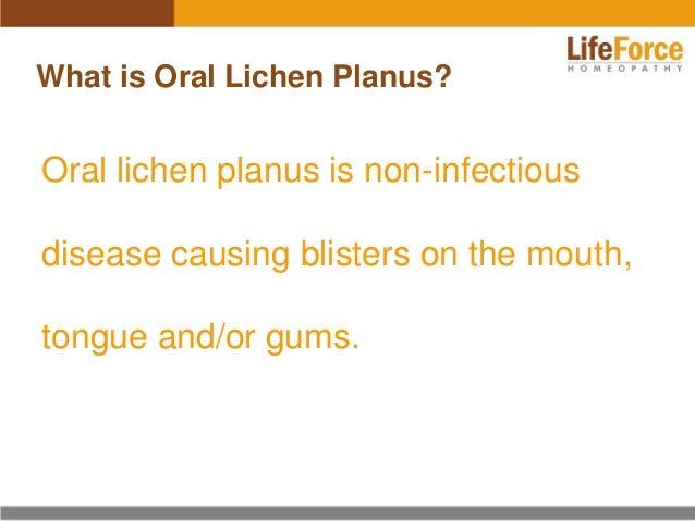 oral-lichen-planus-photos-before-and-after-treatment-pictures-of-mouth-lp-patients-2-638.jpg?cb=1399609783