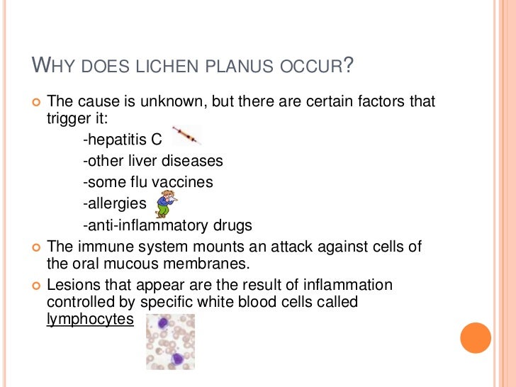 Oral Lichen Planus Treatment & Management: Medical Care ...