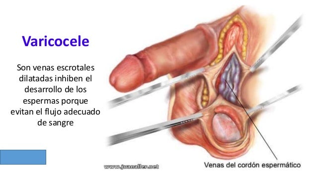 Un pequeño miembro en grande pipiske