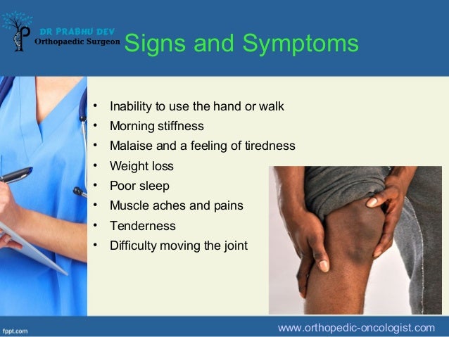 Take Control Of Osteoarthritis pics pics Take Control Of Osteoarthritis