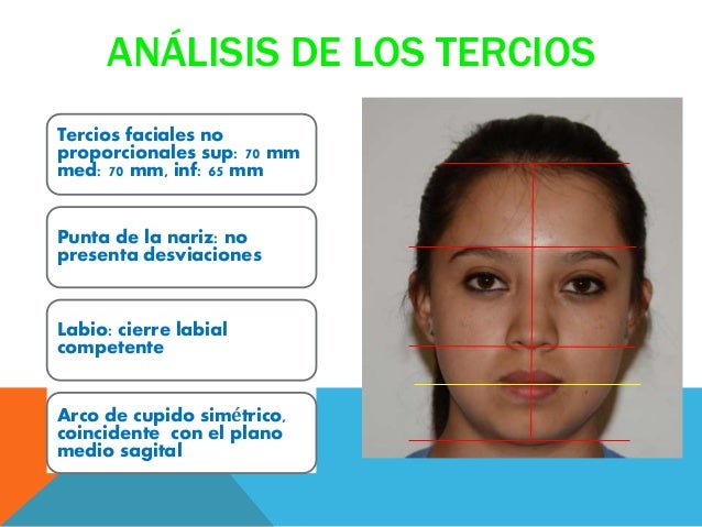 Analisis De Tercios De La Cara