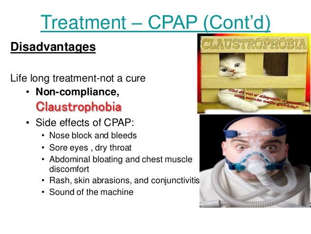 sinus pain and dizziness