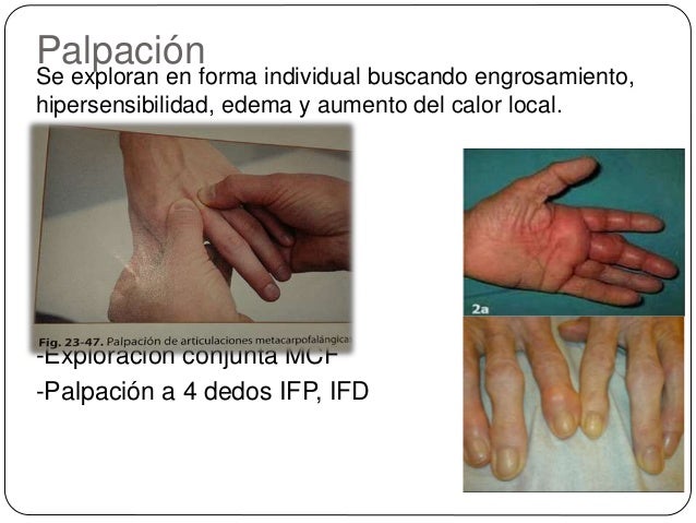 Si puede dar la temperatura la osteocondrosis