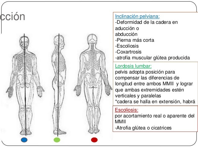 Calmar el dolor a la osteocondrosis sheynom