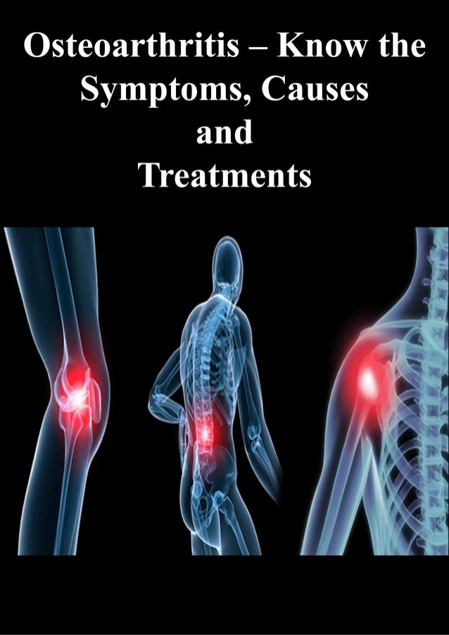 Osteoarthritis know the symptoms, causes and treatments