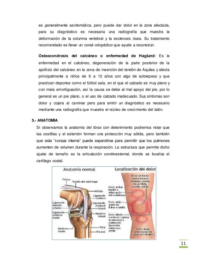 El yoga a la curvatura de la columna vertebral en el departamento de pecho