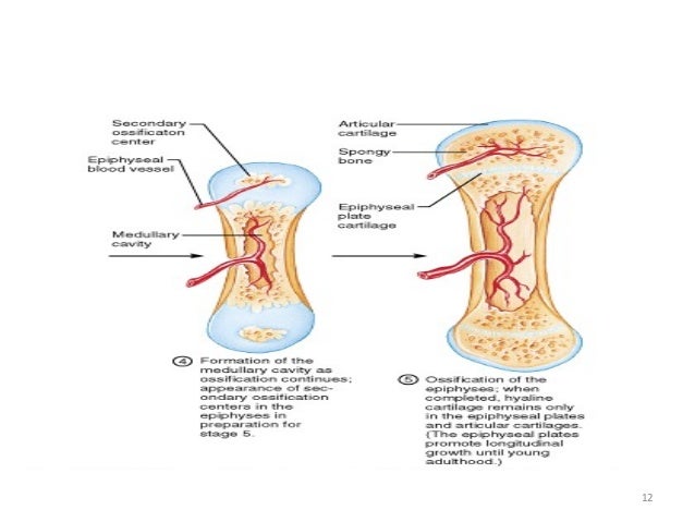 etched blood vessel meaning etched blood vessel meaning