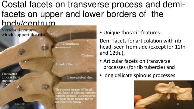 Osteology of thoracic cage