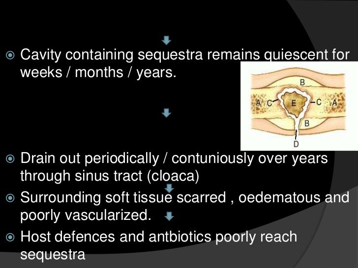 cat has continual sinus troubles symptoms for sinus surgical operation