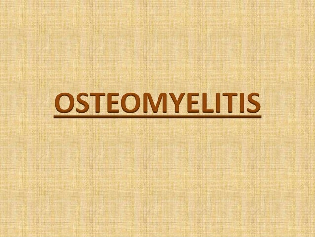 osteomyelitis research paper Osteomyelitis and nursing management we share our knowledge and peer-reveiwed research papers with libraries, scientific and engineering societies, and also work . osteomyelitis research paper Osteomyelitis and nursing management we share our knowledge and peer-reveiwed research papers with libraries, scientific and engineering societies, and also work .