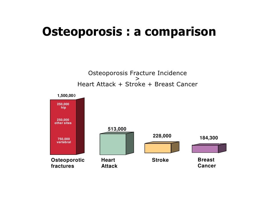 The New Osteoporosis Risk advise The New Osteoporosis Risk advise