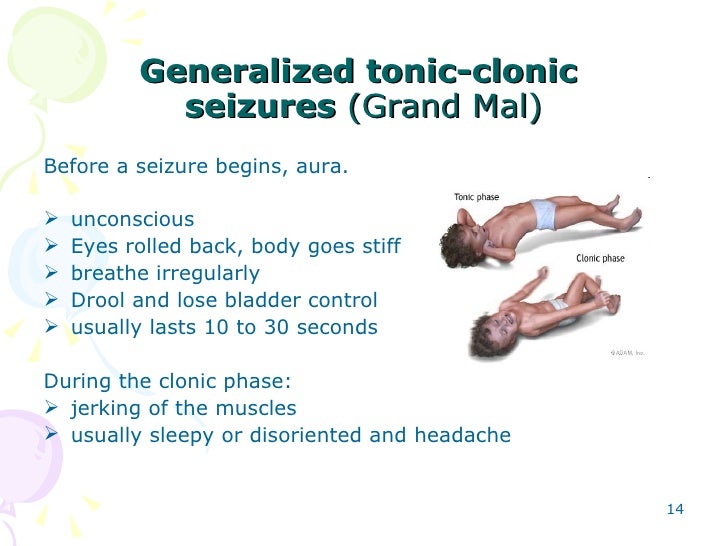 grand mal seizure clonic tonic seizures symptoms pictures to pin on pinsdaddy grand mal seizure clonic tonic seizures symptoms pictures to pin on pinsdaddy