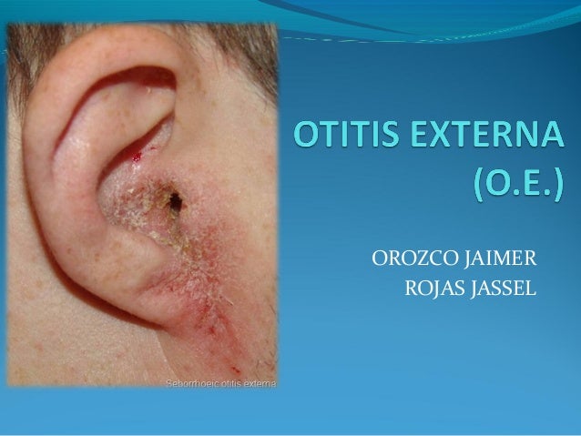 Otitis Externa OTL UCC-Santa Marta. Medicina