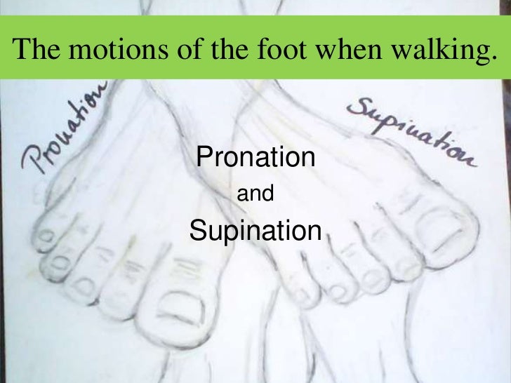 Over-pronation Hyperpronation