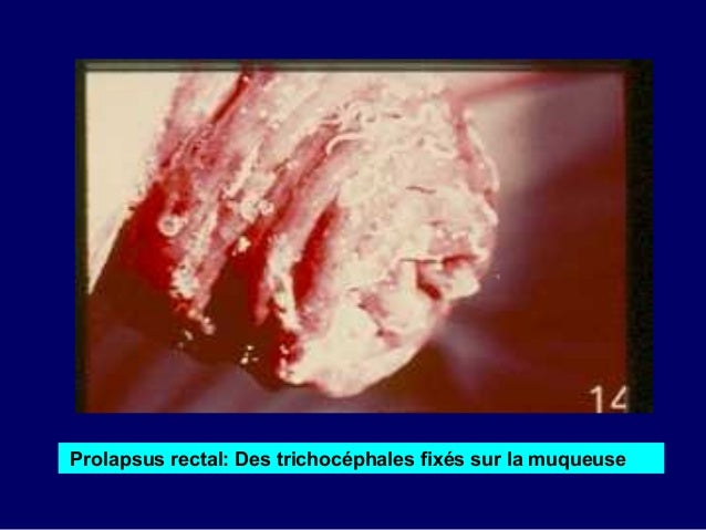 Albendazole Vs Flubendazole : Ampicillin implications Albendazole Vs Flubendazole : Ampicillin implications