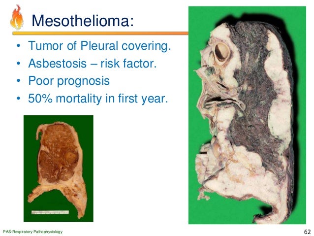 Peritoneal Mesothelioma weight problems