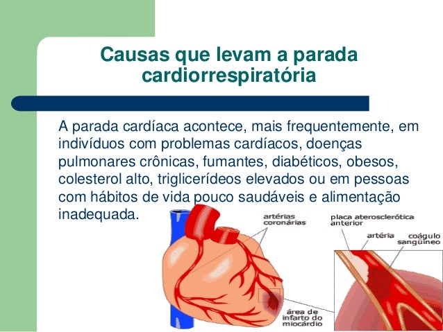 Parada cardio-respiratoria -11 cópia