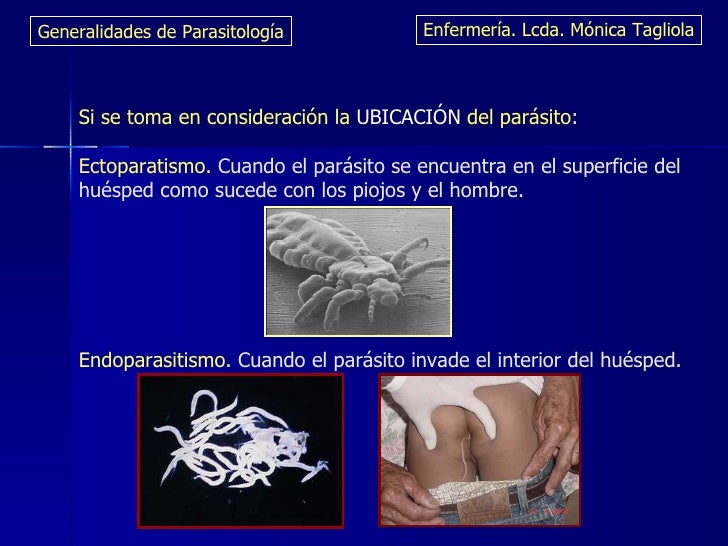La alergia de los parásitos los síntomas