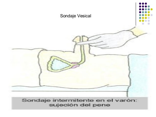 Parte de la unidad 8.clínica básica urinario Parte de la unidad 8.clínica básica urinario