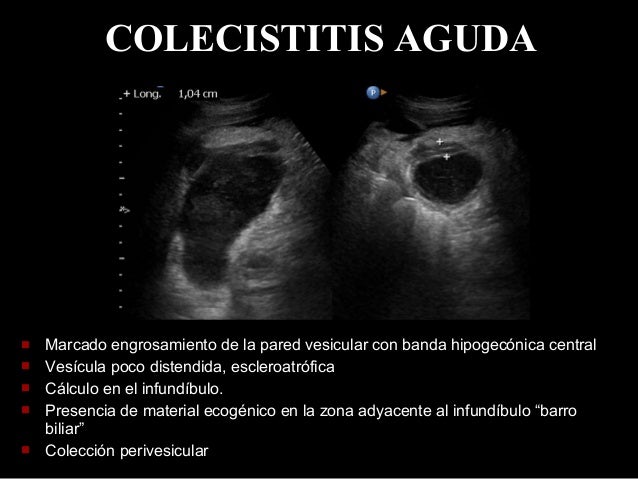 El alcoholismo infantil en estonii