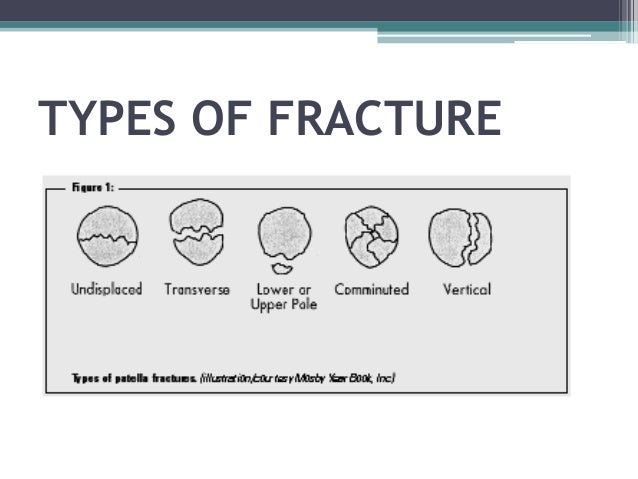 Types of fx