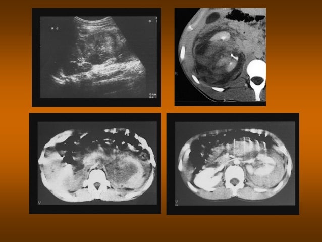 Pathologie de l_appareil_urinaire Pathologie de l_appareil_urinaire
