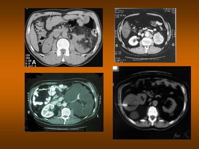 Infection urinaire mst - Carabiens le Forum Infection urinaire mst - Carabiens le Forum