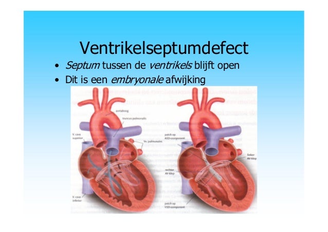 Pathologie hart bloedvaten
