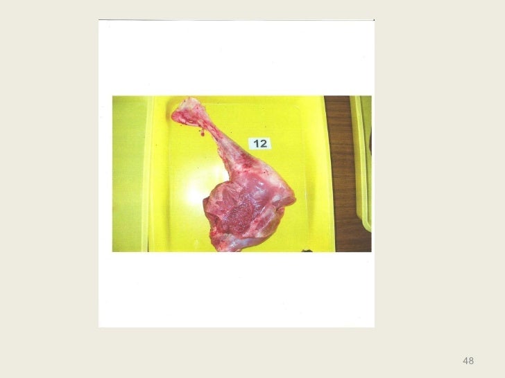 Solving The Interstitial Cystitis Puzzle Amrit Willis natural healing guide 2003 Solving The Interstitial Cystitis Puzzle Amrit Willis natural healing guide 2003
