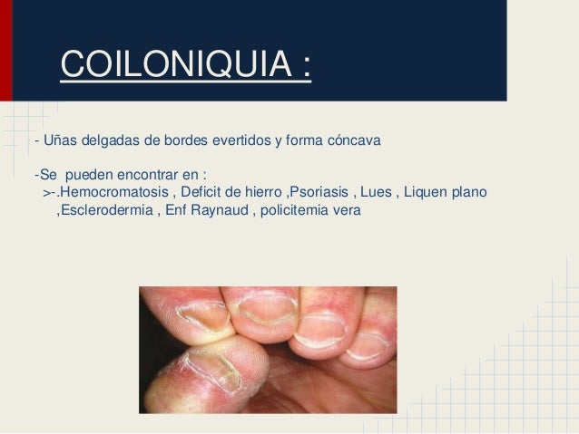 Atopichesky la dermatitis la depuración del organismo