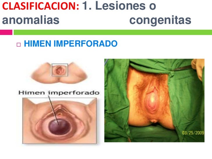 El tratamiento del intestino a la psoriasis